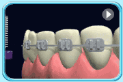 牙卫士口腔